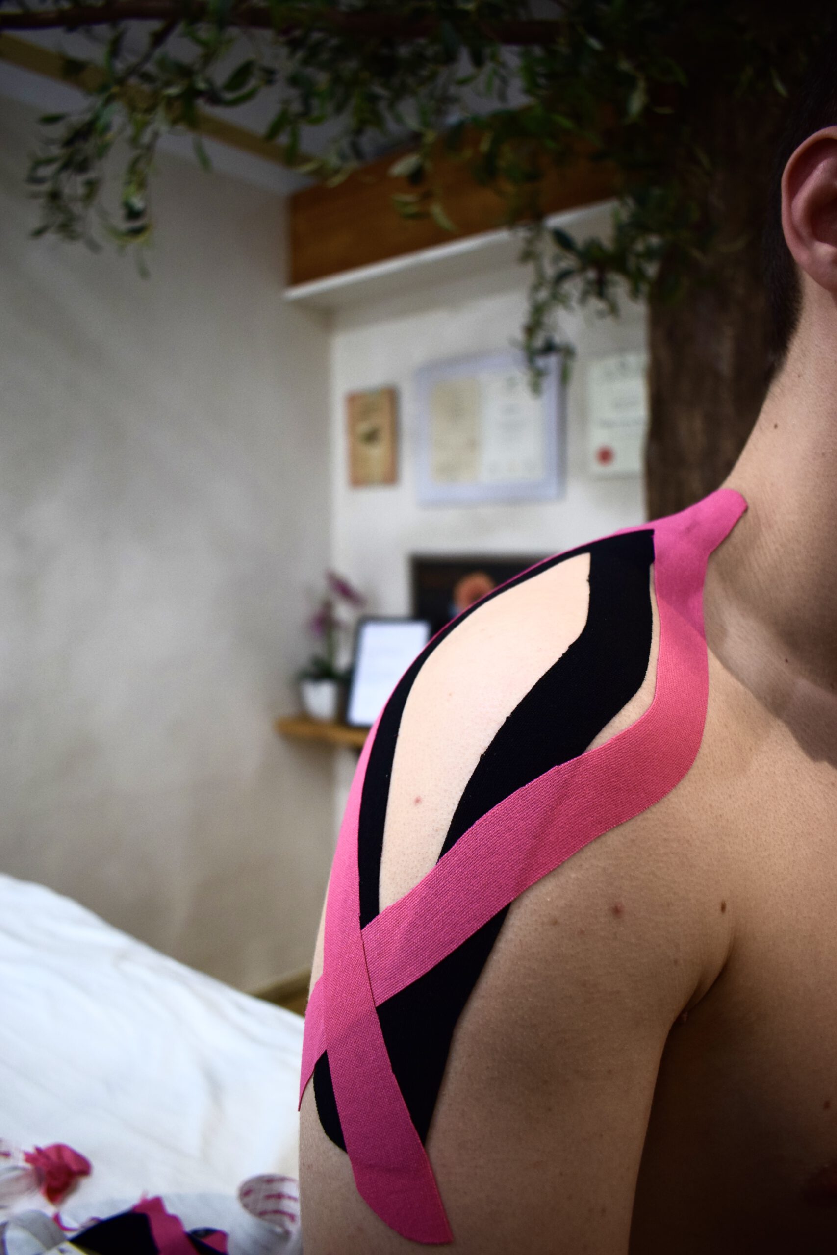 Application of kinesiology tape on a client's shoulder